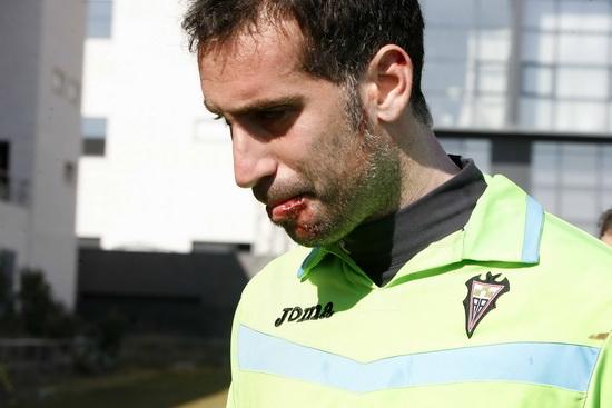 Miguel Martínez recibió puntos de sutura en lengua y labios al finalizar el encuentro
